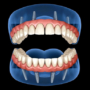 Cosa fare se hai perso tutti (o quasi) i tuoi denti?