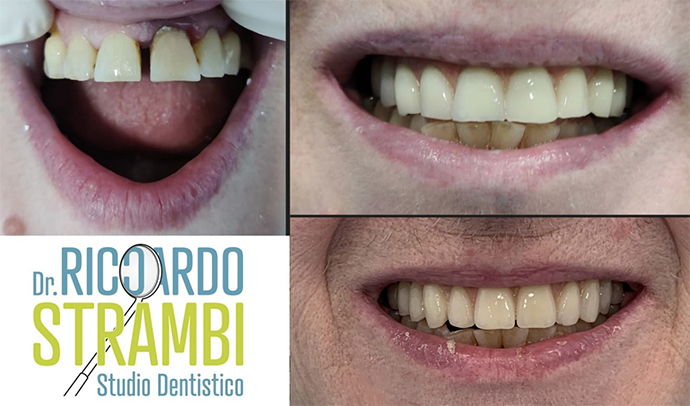 Dentista Dr. Riccardo Strambi